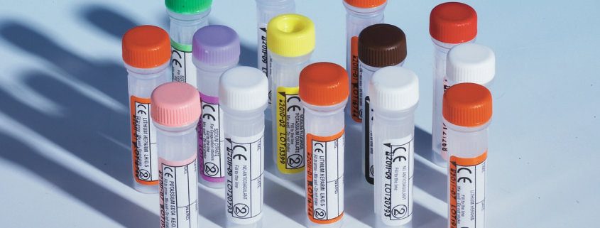 Screw Cap Paediatric Blood Collection Tubes