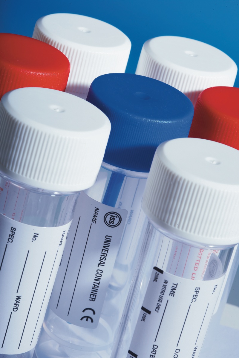 Specimen Containers: Universals, Dippers, Sample Tubes